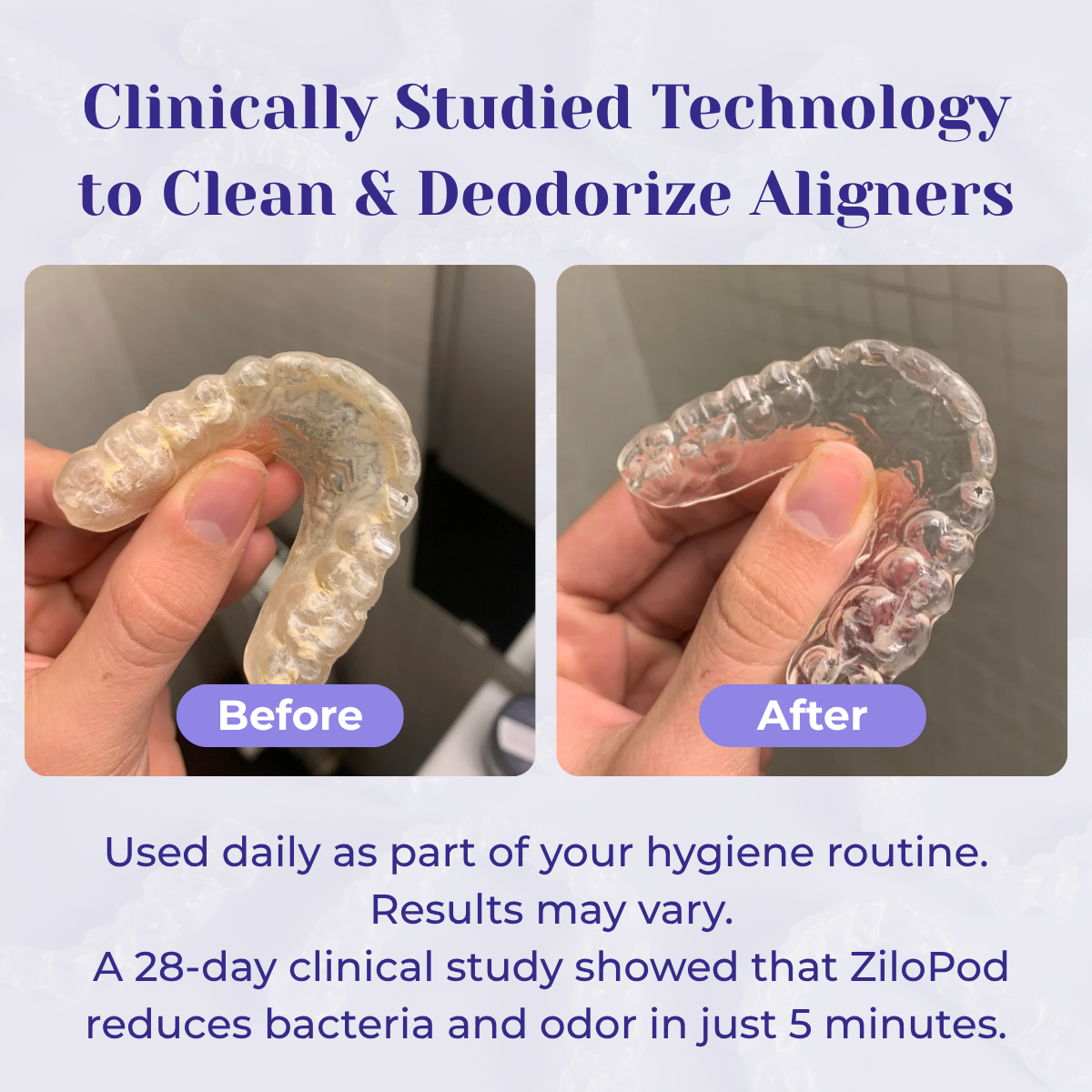ZiloPod - #1 Dentist-Approved Ultrasonic & UVC Cleaner
